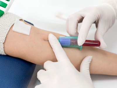 A health care professional drawing a blood sample.